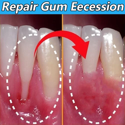 Imagen 2 del producto Suero de Gel para el cuidado de las encías dañadas, 60ML, alivia las encías dolorosas, alergias, limpieza profunda, manchas de dientes, sarro, suero, pasta de dientes para caries dentales