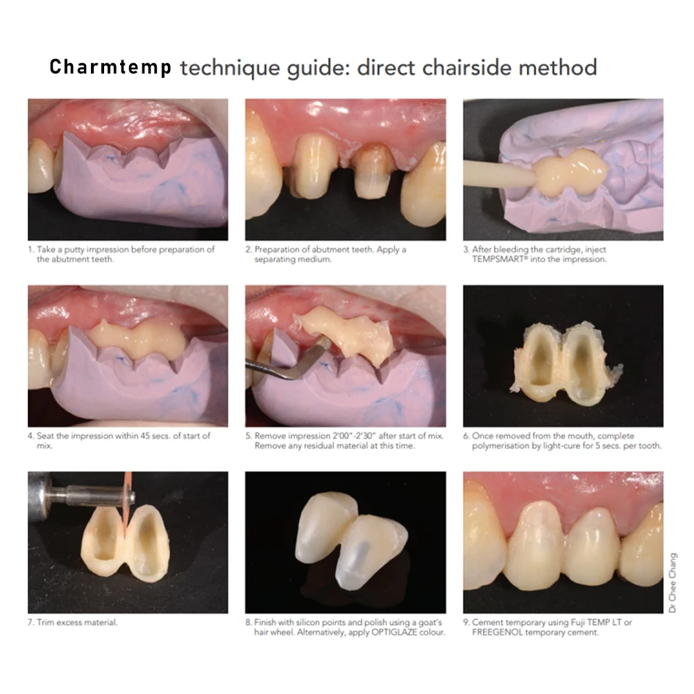 Coroa Dental Temporária e Material Ponte, Resina Auto Cura Automix, Luxa Pro CharmTemp, Dentes frontais anteriores, Suprimentos para Odontologia