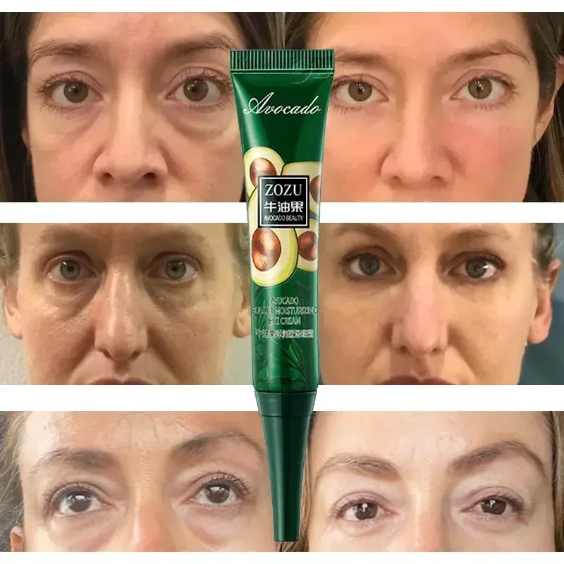 Instant Remove Wrinkles Eye Cream, Fade Fine Line, Anti-envelhecimento, círculos escuros, bolsas, inchaço, apertar, branquear, sob os olhos, cuidados com a pele