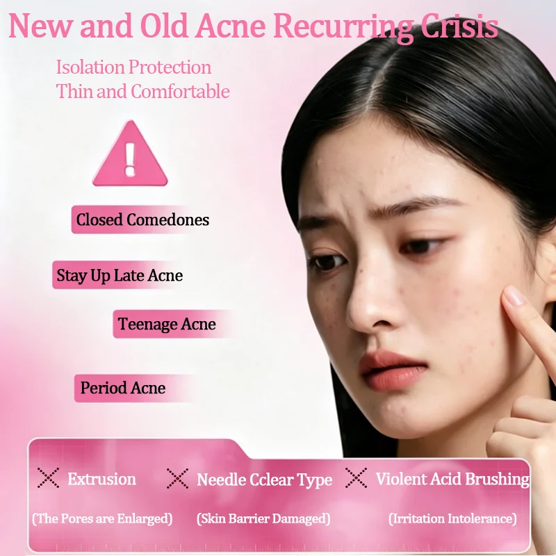 Medical Hydrocolloid Invisible Acne Patch Waterproof Ultra Thin Spot Cover Stickers Facial Blemish