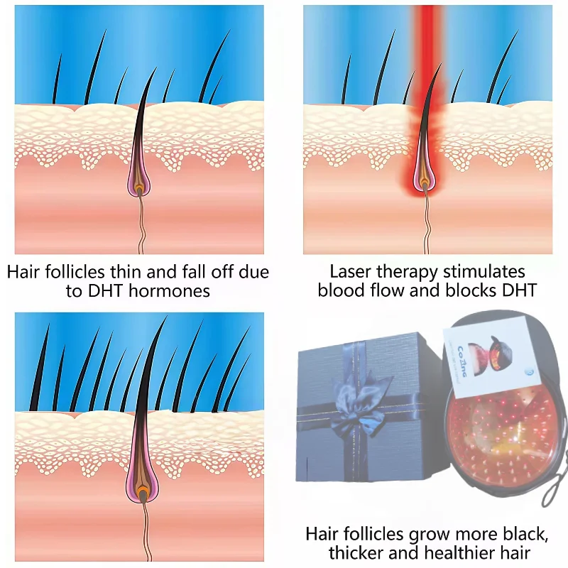 

96. Лазерная шапочка для роста волос для мужчин и женщин, шлем LLLT, устройство для лечения против выпадения волос, истончение линии роста волос.