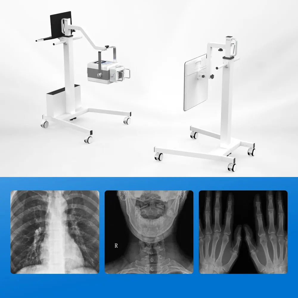 Portable Simple X-ray Machine Mobile X-Ray Machine In Hospital Medical Clinics Nursing Homes Clear Imaging Simple Operation