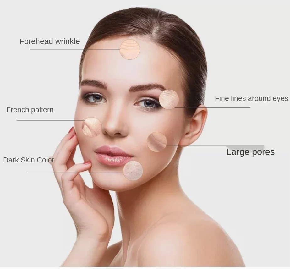 Urządzenie kosmetyczne 6 w 1: plazma, termiczna maszyna do bąbelków, hydrofacial wodorowo-tlenowy, jonowy młotek zimny, RF, bipolarny polimer-woda