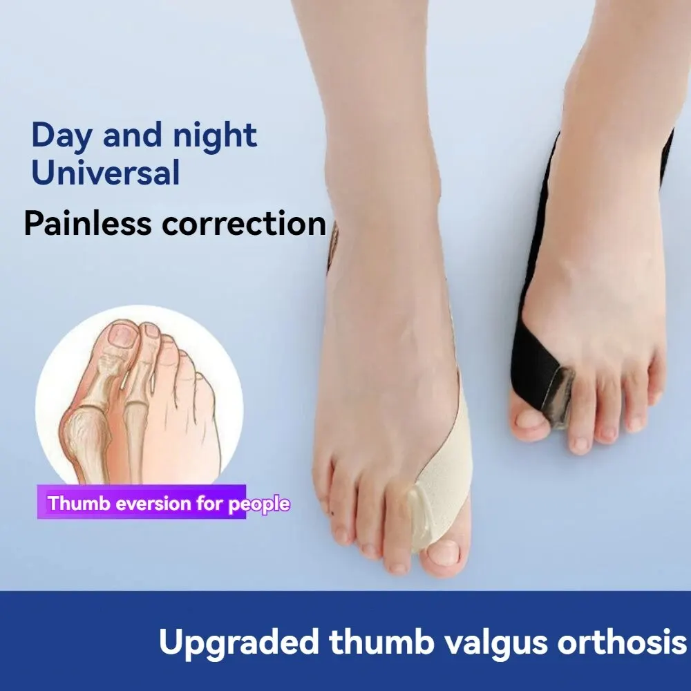 Unilateral Pull Bunion Orthosis Day and Night Shoeable Bigfoot Overlap Toe Separator Tension Strap Cloths