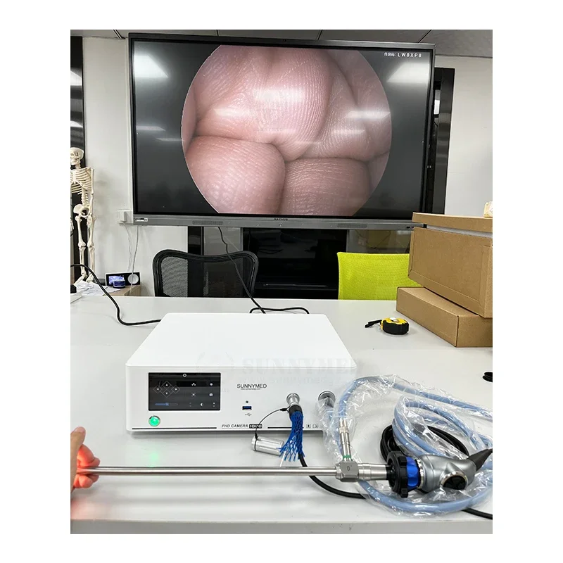 SY-PS048T ent anorectal endoscopy portable endoscopic camera ent endoscopy systems equipment endoscopy of ear nose and throat