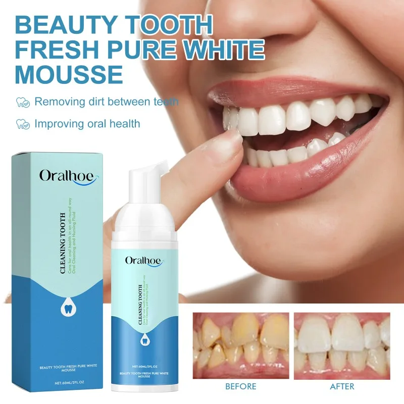 Beauty Tooth Fresh Pure White Mousse Removing Breath Yellow Teeth Stains Brighten White Fresh Breath Health Management Products