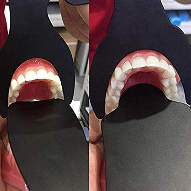 Dentist Dental Photo Contrast Black Background Board Autoclavable Dental Contrast Intraoral Photographic Mirror