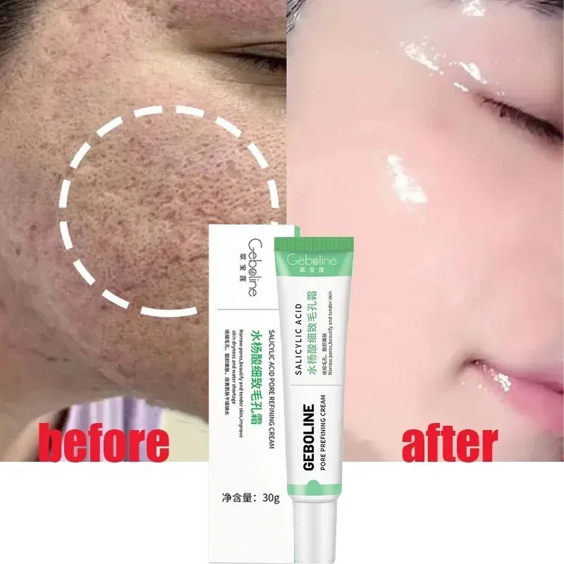 Crème de rétrécissement des pores à l'acide salicVAC, élimination rapide des grands pores, élimine les points noirs, resserre le visage, lisse la peau, produit de soin coréen