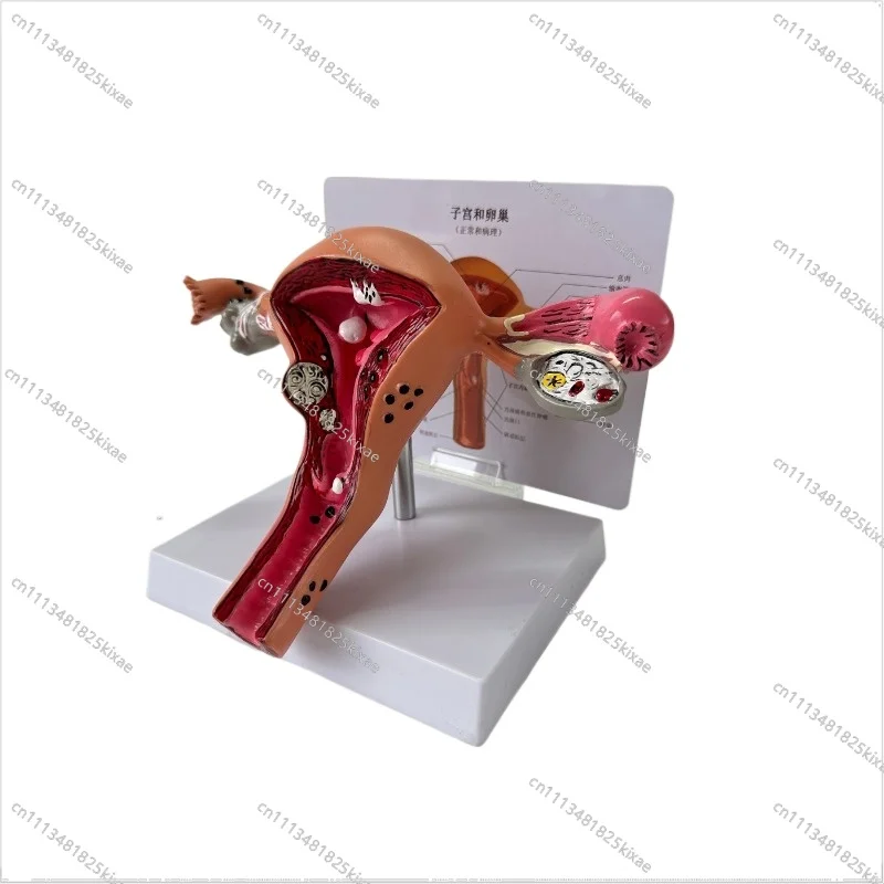 For Human Female Reproductive Uterus Anatomy Pathological Model Vaginal Ovary Teaching  Gynecological Reproductive Aids