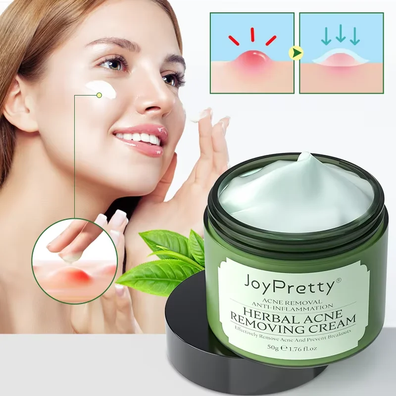 Joyprettyin Face Cream Shrink Pore Blackehead Remover Elimination Large Pores Moisturizing Smooth Facial Skin Care Cream 50g