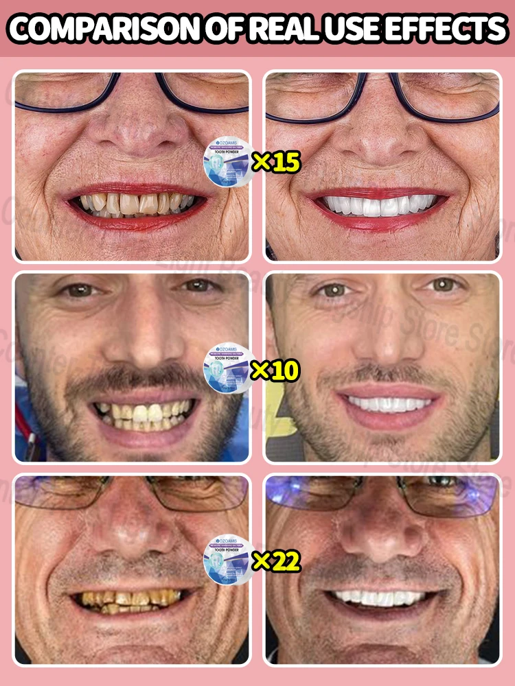 Get white, sparkling teeth fast！
