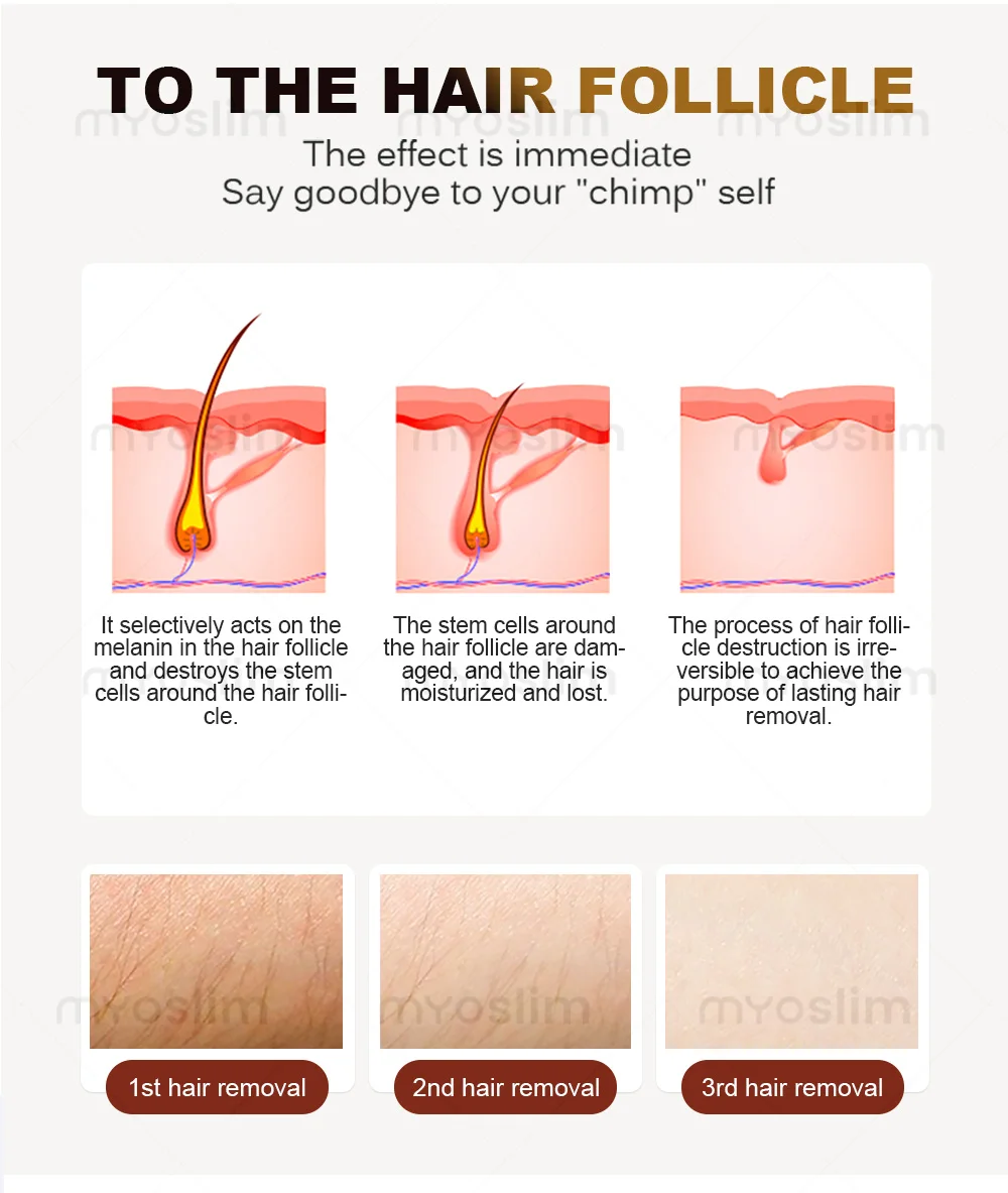 Portable 808 3wave Diode Laser Permanent Hair Remove Fast Depilation Painfree Follicle Penetration Skin Rejuvenation Device