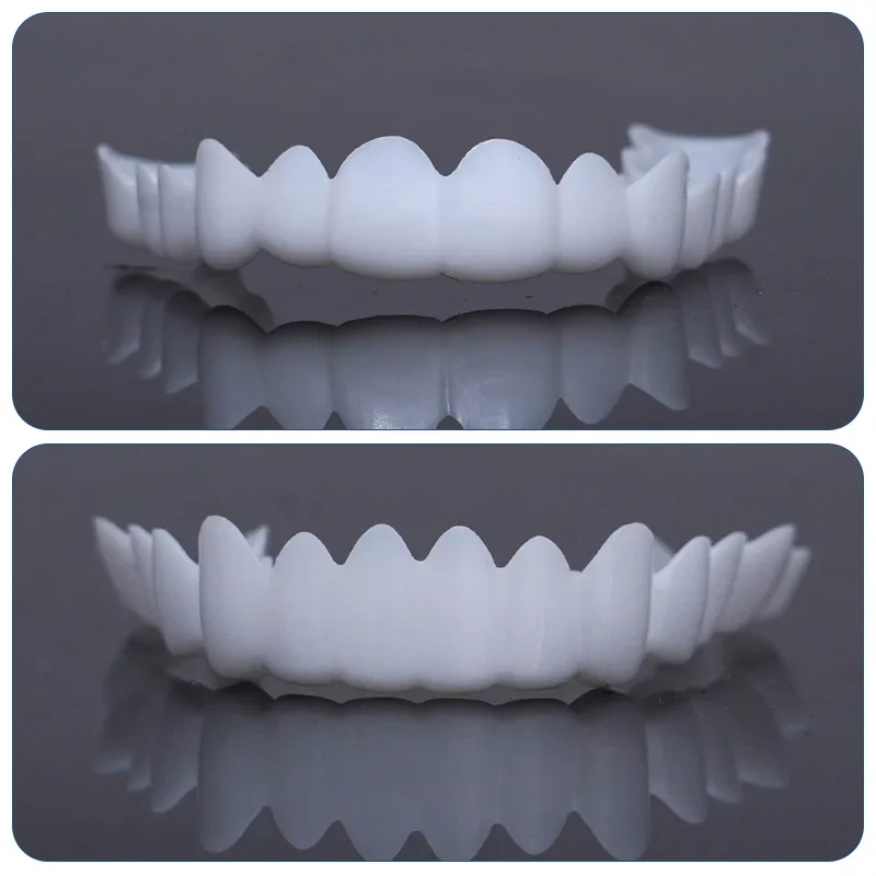 Sdatter Dental Perfect Fit Teeth Whitening Fake Tooth Cover Adjustable Temporary Resin False Braces Snap On Smile Veneers Prosth