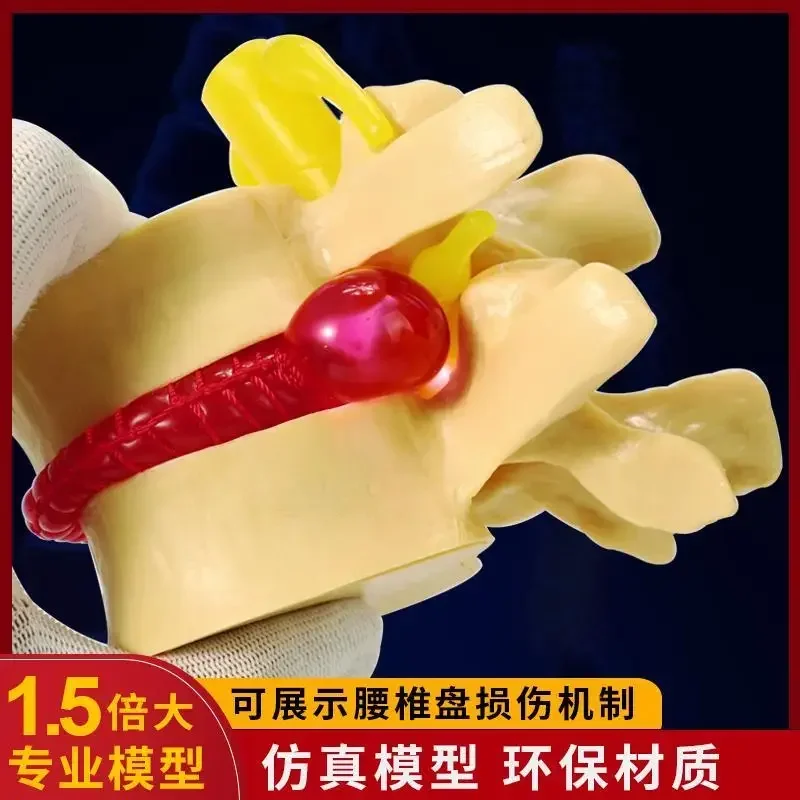 A Demonstration Model Of Human Lumbar Intervertebral Disc Compression Spinal Spinal Skeletal Pathology Teaching Aids