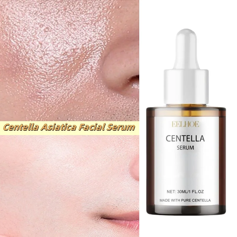 

Centella Asiatica Facial Serum Moisturize Nourish Improvement Dry Skin Smoothing Rejuvenation Brightening Beauty Health