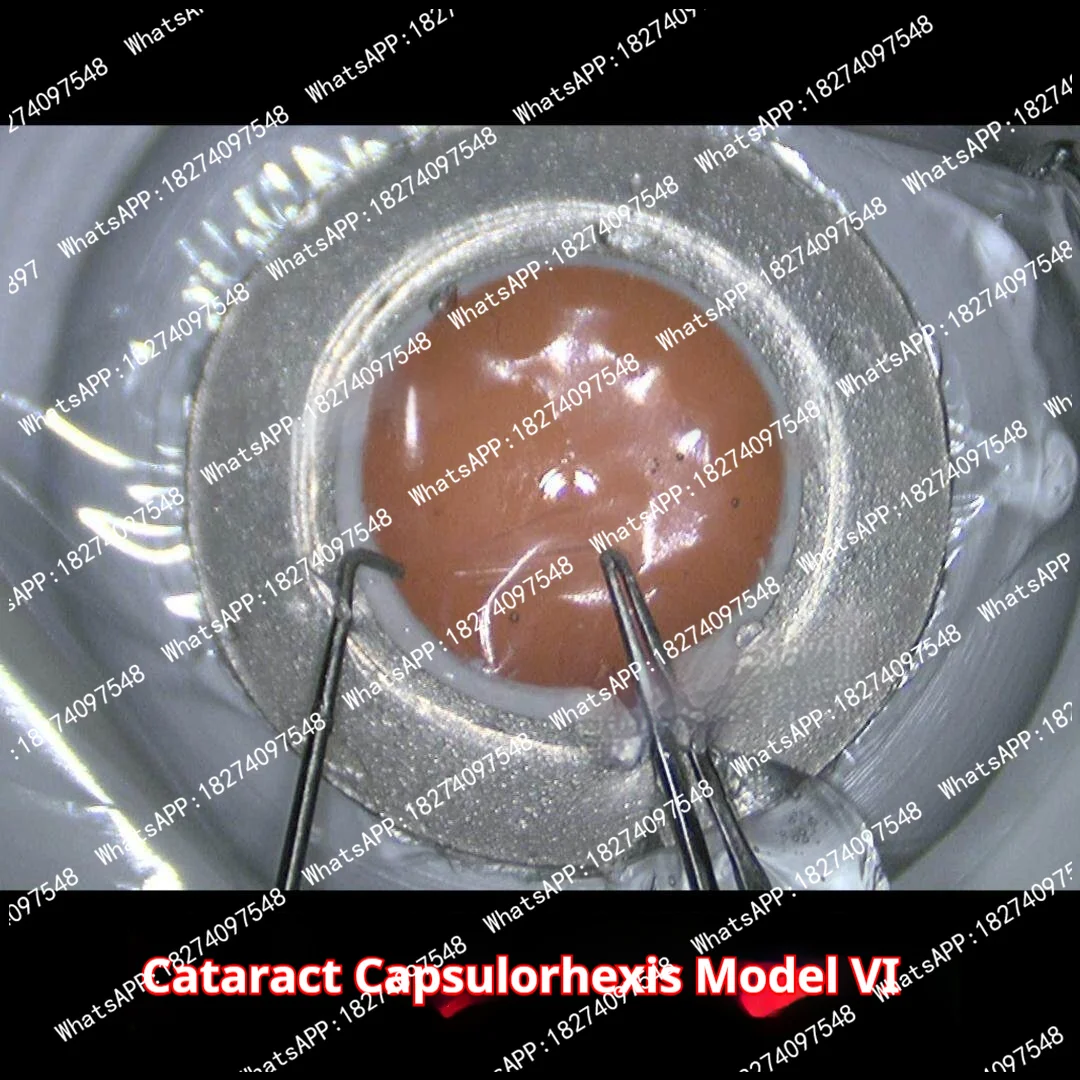 V/IV Ophthalmic Cataract Ultrasonic Emulsification Capsulorhexis Surgery Practice Model Realistic Red Reflex for Authentic Feel