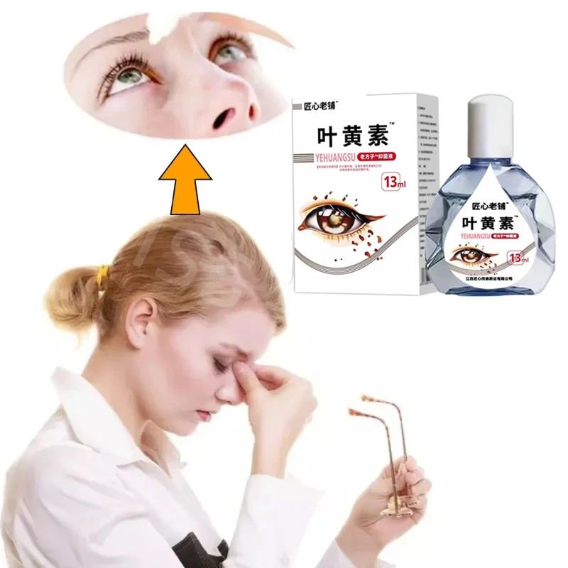 1/2PCS Lutein Eye Drops Relieve Eye Fatigue and Dryness Improve Vision Eye Care for Shadow Cloudy Blurred Vision Drops B6,E