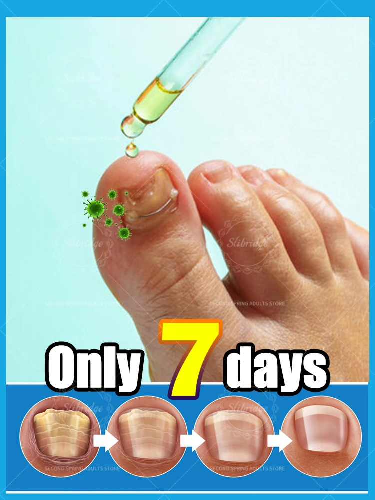 

manicure for bad Can in 7 days farewell