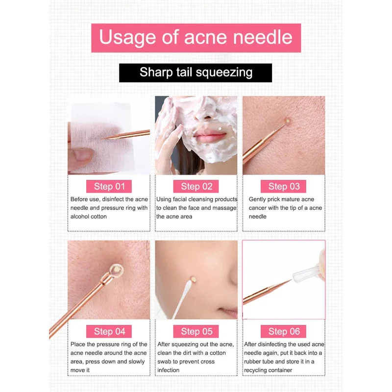 Comedondrukker Puistje Comedo Extractor Tool Beste Acne Verwijdering Kit Behandeling voor Smet Whitehead Popping Zit Verwijderen voor