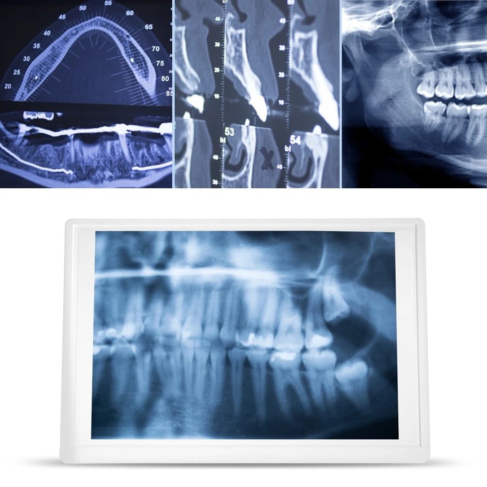 AC110-220V scatola di osservazione per visualizzatore di pellicole dentali scatola di osservazione a LED con Clip per Chip di staffa forniture dentali speciali per laboratorio odontotecnico