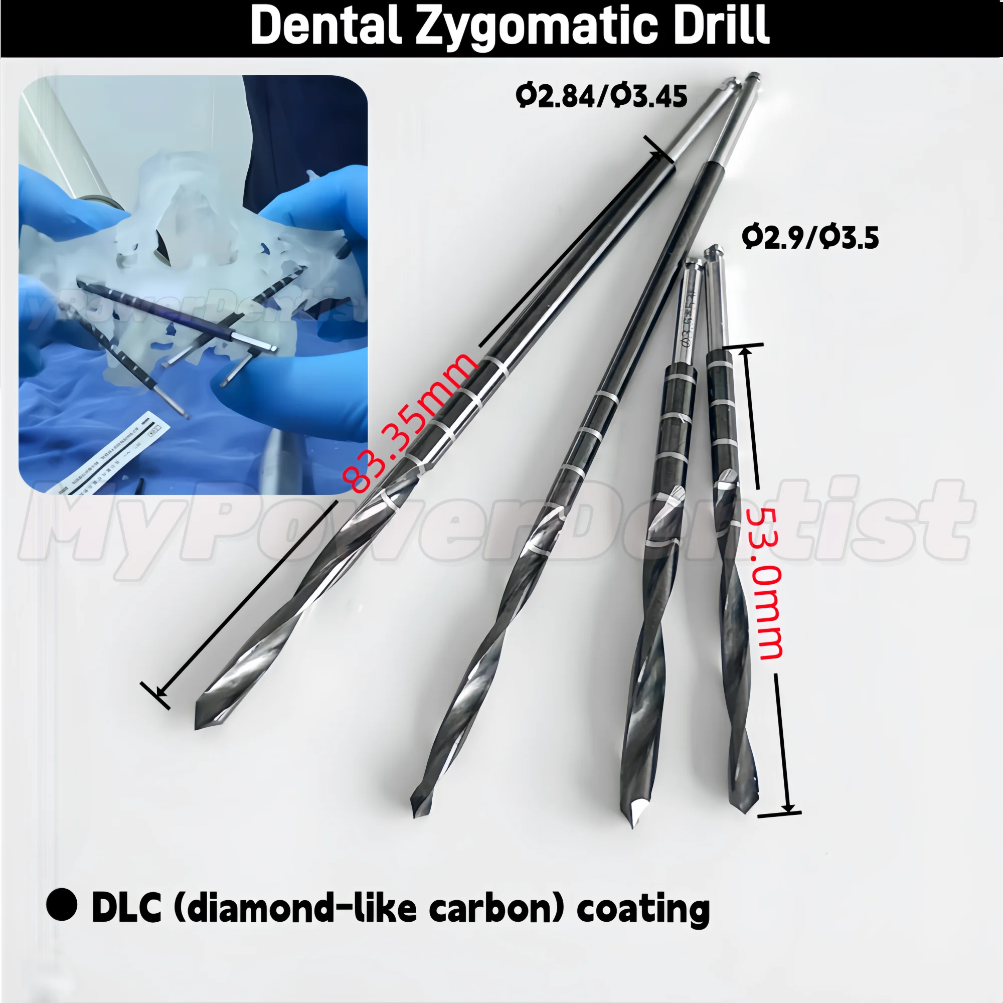 Dental Zygomatic Dr…