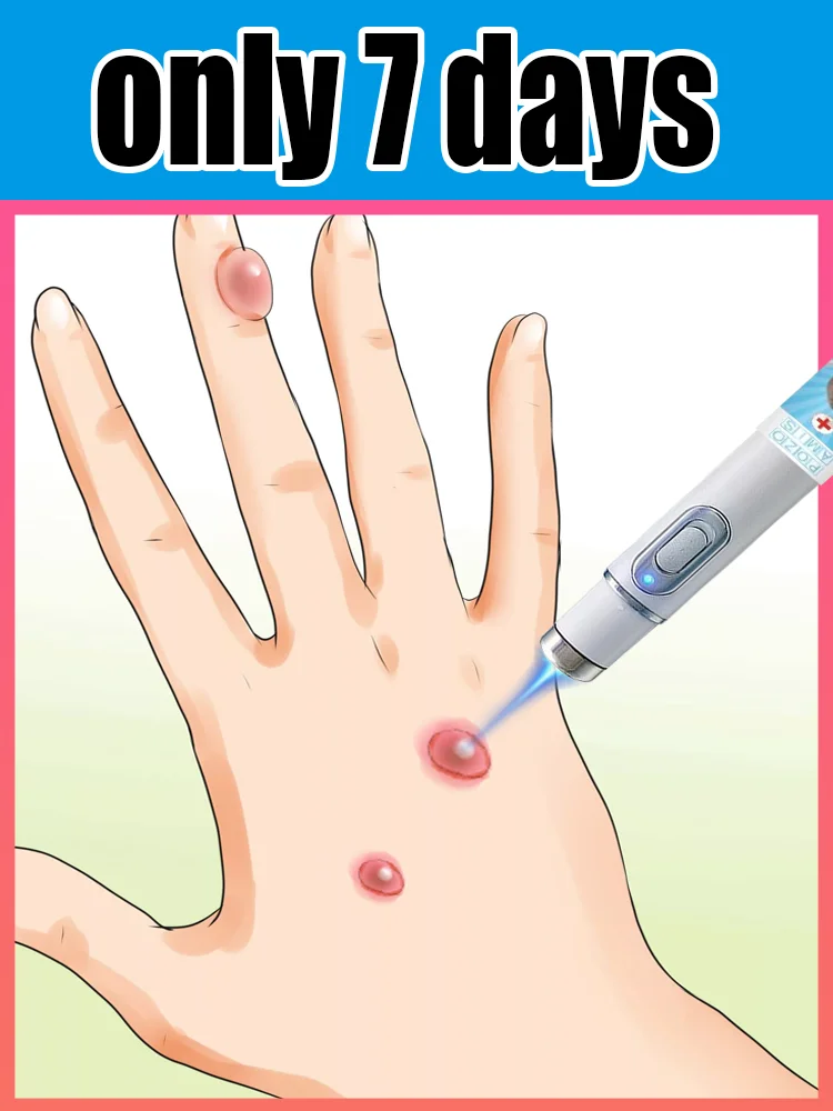 ʙʟᴜᴇ ʟɪɢʜᴛ ᴘᴇɴ sᴏʟᴠᴇ ᴡᴀʀᴛs, ʜᴏᴛ sᴀʟᴇ ᴡᴀʀᴛ ᴄᴀʀᴇ ᴛᴏᴏʟs