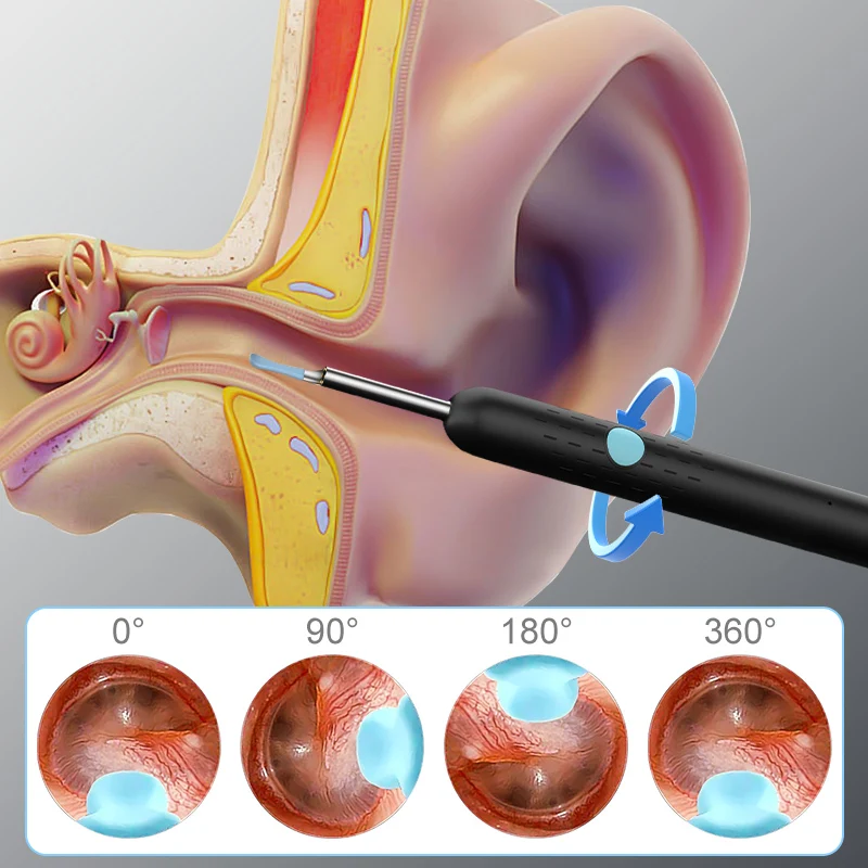 Smart Wireless Ear Cleaner with Gyroscope Stabilization 2.4G HD Ear Camera Auto-Direction Lock 35Min Runtime 130mAh Fast-Charge