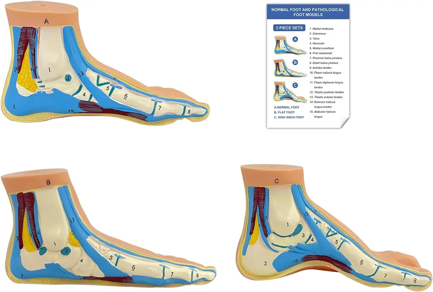 An Anatomical Model of the Human Foot with Numbered Structures, Life-Size Flat Feet for Education, Podiatry Research, and Patient Demonstration