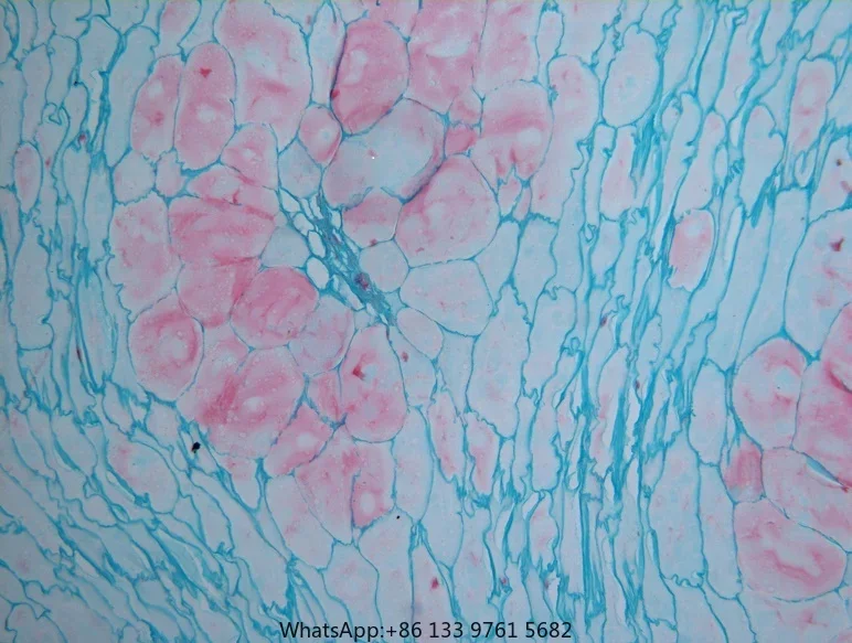 Bestscope BS-2052B InfiniteSemi-Plan Achromatic Objectives 40X-1000X WF10X/20mm Binocular Biological Medical Microscope