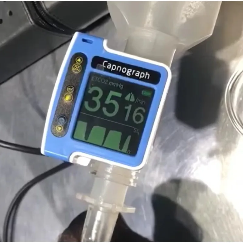 Capnoeasy Carbon Dioxide Monitor Is an All-solid-state Design Mini Monitor with Its Own Audible and Visual Alarm System.