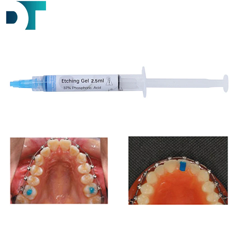

10pcs Dental Etching Gel 37% Dental Materials Teeth Cleaning Adhesive Resin Braces Bonding Glue Phosphoric Acid Etchant