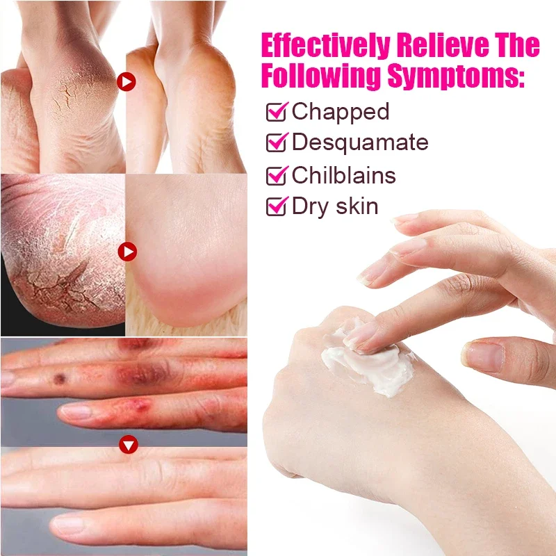 1Pcs Anti-Drying Crack Ointment Hand Foot Heel Cracked Repair Plaster Removal Dead Skin Care Chinese Herbal Medicine Cream S101