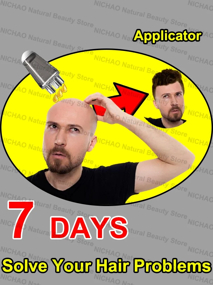

7 Days Fast Hair Growth Essential Loss Regrowth Treatment Strengthens Hair Nourishes Scalp Light Weight Non Greasy