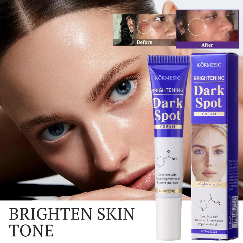 

Niacinamide Brightening Spot Cream Reduce Chloasma Melasma Melanin Fade Fine Lines Fade Dark Spot Dulless Moisturising Face Care