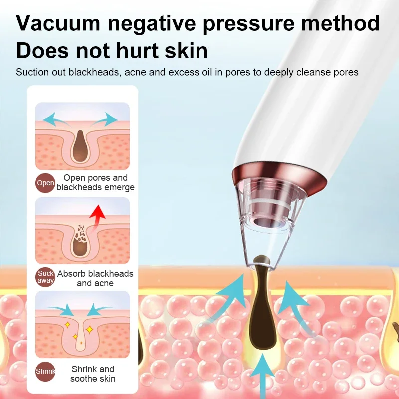 전동 블랙헤드 제거기 진공 여드름 클리너 6개 노즐 블랙 스팟 제거 얼굴 딥 클렌징 모공 클리너 기계 피부용