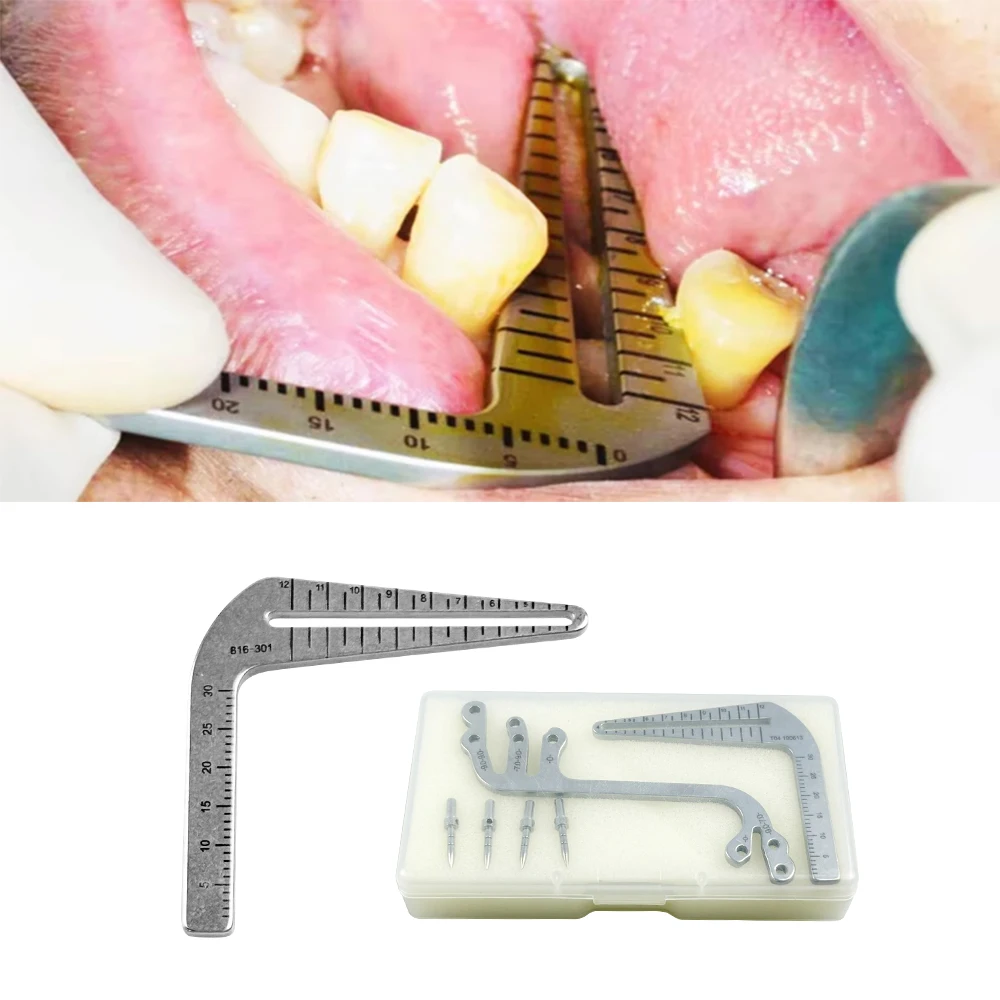 

Набор направляющих для зубного имплантата, стоматологический калибр, линейка, локатор для посадки полости рта, руководство по позиционированию, угловая линейка для сверления, инструмент для имплантации стоматолога