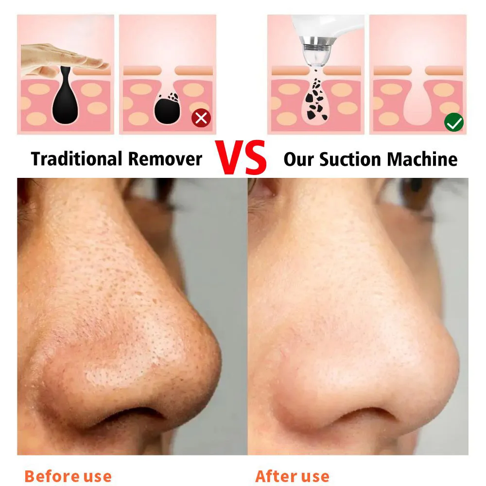 Extracteur de points noirs pour le nez, Machine de nettoyage des pores, aspirateur en profondeur, Rechargeable par USB, acné, boutons, aspiration sous vide, 2023