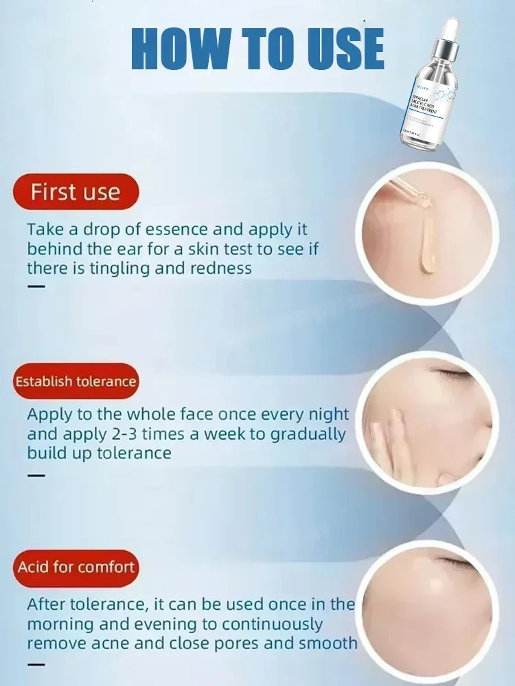 3RD محلول حمض الساليسيليك جوهر حب الشباب إزالة بقعة تقليص المسام السيطرة على النفط سطع المصل ، تقليل حب الشباب ، ترطيب ، تهدئة