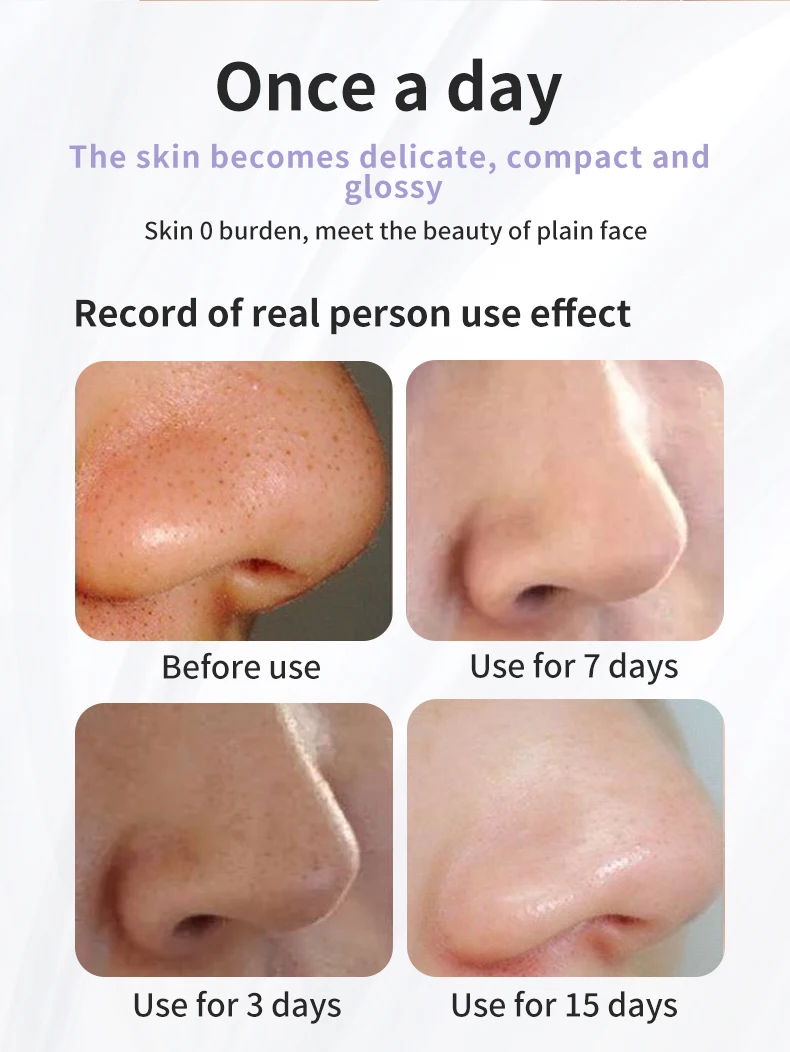 منتج التجميل منظف الوجه الكهربائية الصغيرة فقاعة دورة المياه حب الشباب المسام فراغ جهاز إزالة الرؤوس السوداء #3