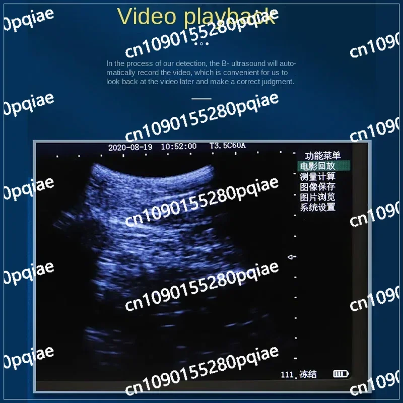 Cattle Test 5.6 Inch Screen Veterinary Ultrasound Scanner Cow Pig Heep Horse Farm Portable Ultrasound Pregnancy Testing Machine