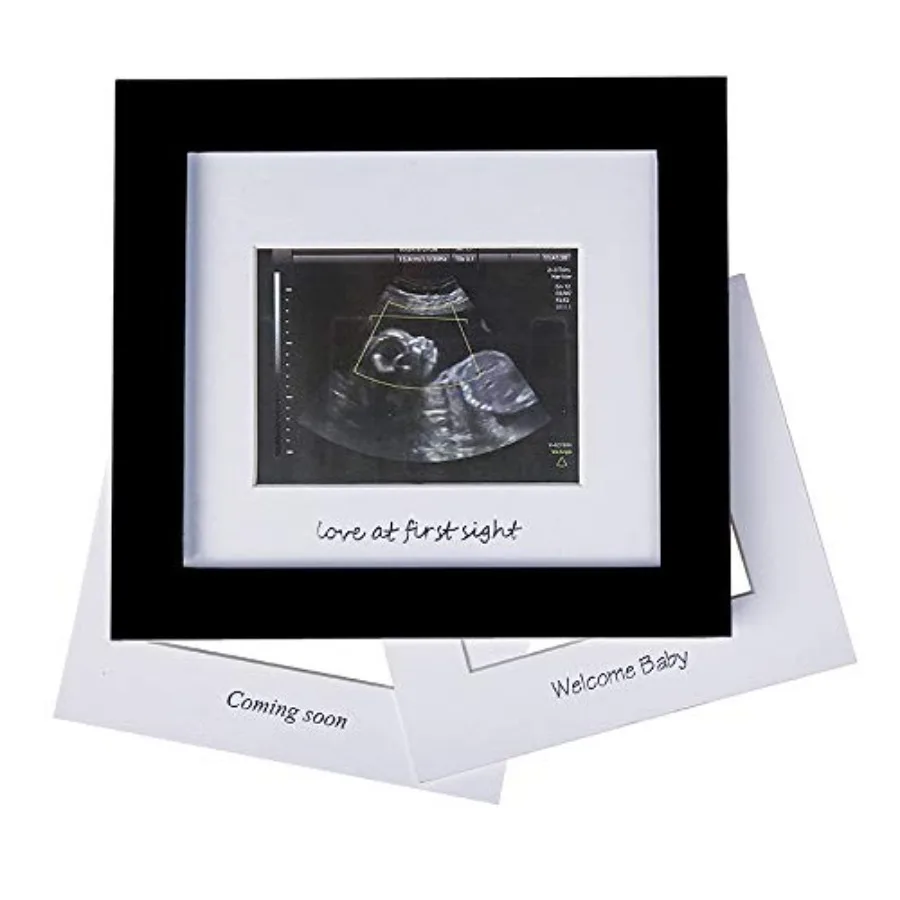 

Baby Sonogram Photo Frame - 1st Ultrasound Picture Frame - Idea Gift for Expecting Parents, Baby Shower, Gender Reveal Party, B