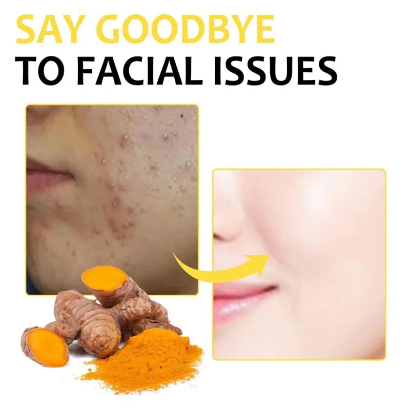 Mee-eterreinigingspleister verwijdert overtollige olie Natuurlijke plantaardige ingrediënten Hydrateert en verheldert het gezicht Gezichtsreinigingstoolset