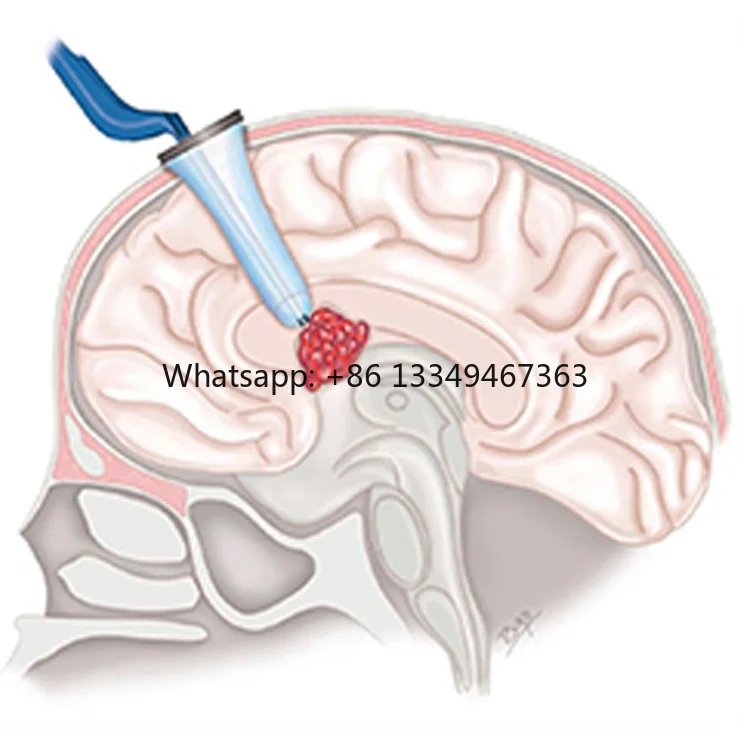 Medical Consumables Disposable Viewsite Brain Access System Transparent Tubular Retractors  for Brain Surgery