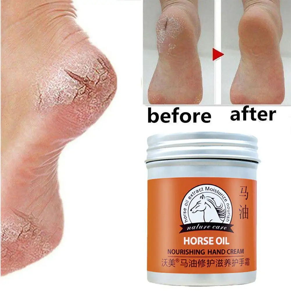 

80g Horse Oil Anti-Drying Crack Foot Cream Heel Cracked Repair Cream Moisturizing Removal Dead Skin Hand Foot Balm Skin Care hot