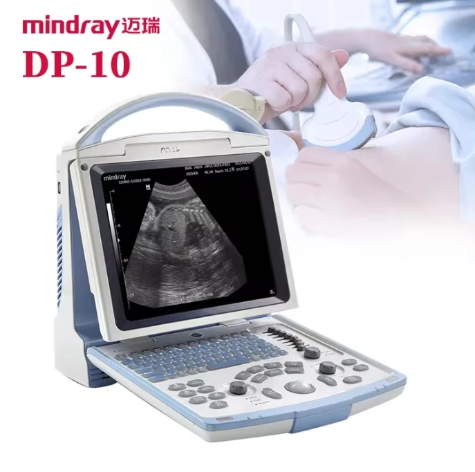 mindray dp 10 ultrasound laptop mindray ultrasound portable ultrasound machine