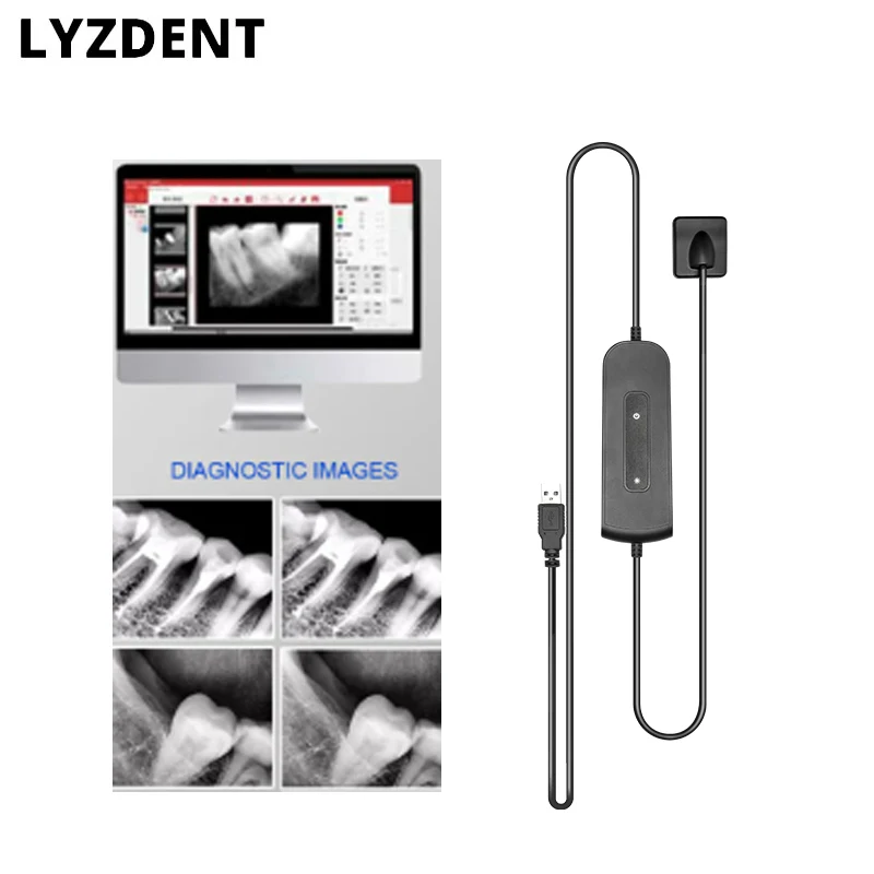 Dentist Digital cameras Dental Sensor X-Ray High-Frequency Rx Digital Intraoral Digital System H D Image Radiovisografo