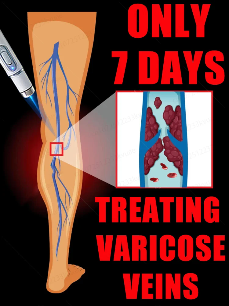 

The latest third-generation blue light pen for varicose vein treatment