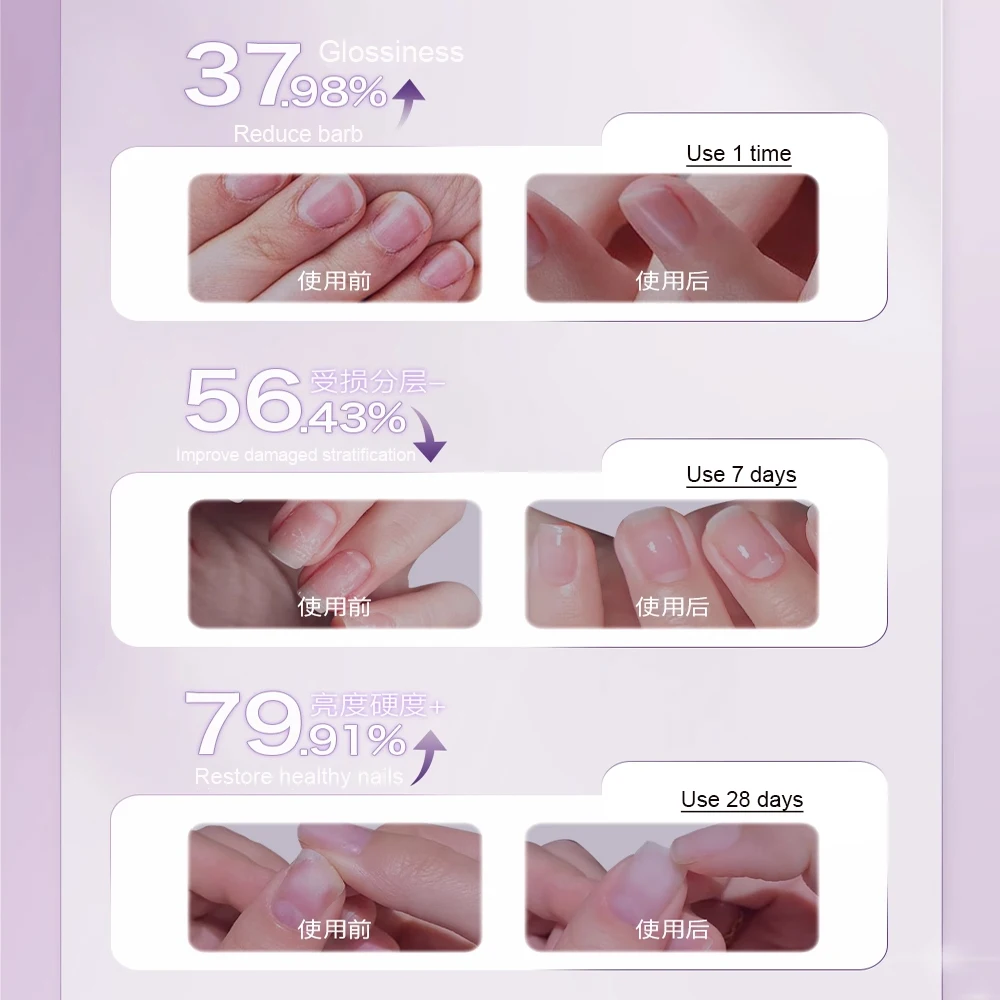 1pcs 3 In 1 Remover Dead Skin Essence Pen For Nail Repair Nail Cuticles Pusher Pen Anti-barb Nourishing Nail Nutrition Oil Pen