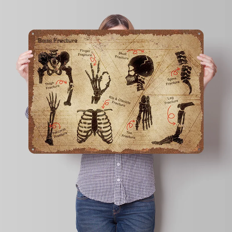 Bone Fracture Metal Poster Customized Wall Art Retro Vintage Tinplate Signs for Man Cave Coffee Bar Accessories Home Decor Items