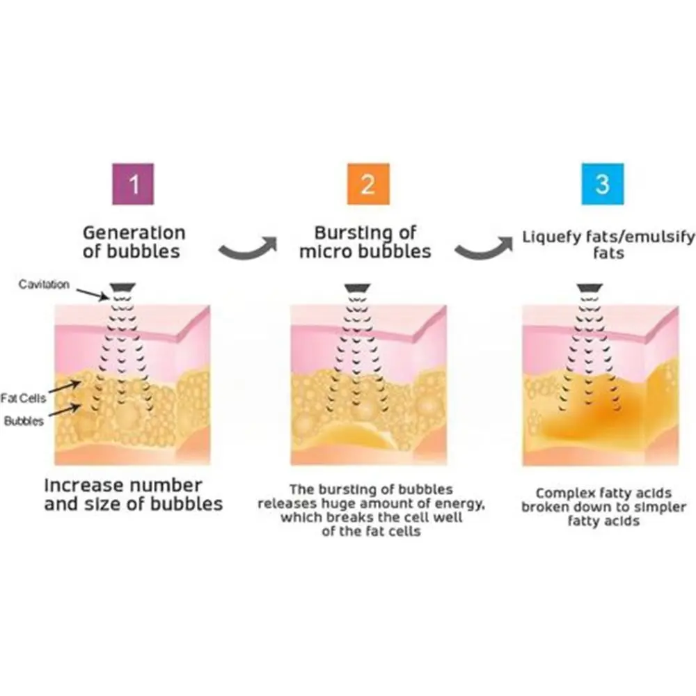المغناطيسي معدل ضربات القلب اللياقة البدنية عداد الخطى اللمفاوي السموم سوار بالموجات فوق الصوتية سوار شكل الجسم معصمه الأساور الذكية